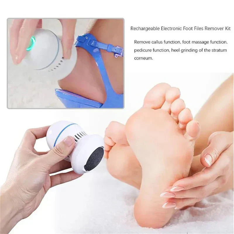 SilkSure – Removedor elèctric de durícies amb aspiració – pedicura a casa