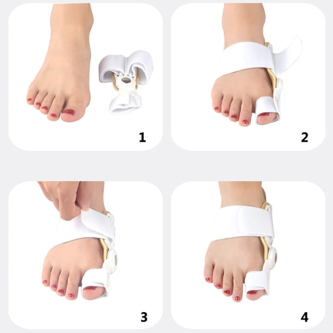 FlexiToe Teenstrekker – Correctie bij Hallux Valgus Zonder Chirurgie