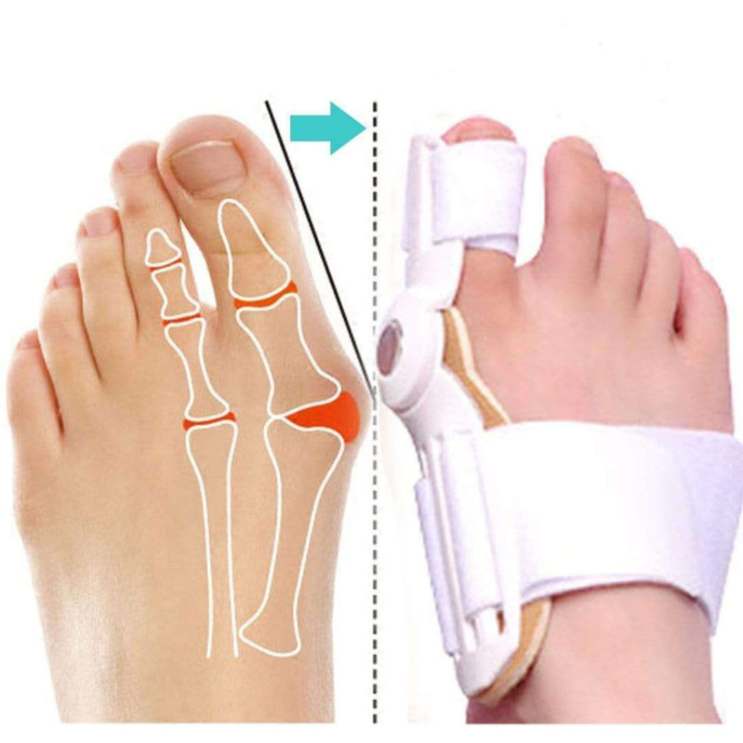 FlexiToe Teenstrekker – Correctie bij Hallux Valgus Zonder Chirurgie