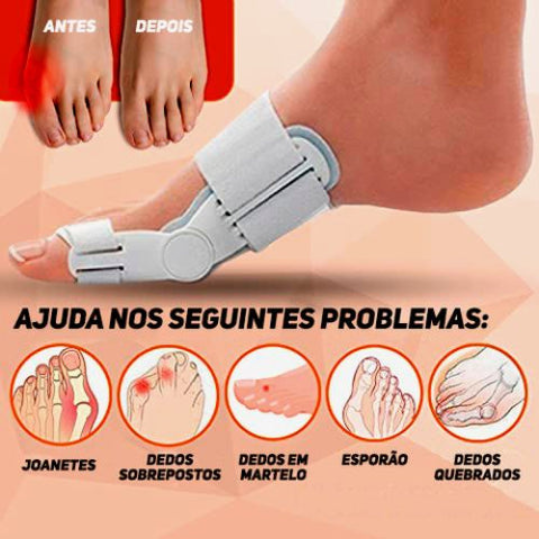 FlexiToe Teenstrekker – Correctie bij Hallux Valgus Zonder Chirurgie