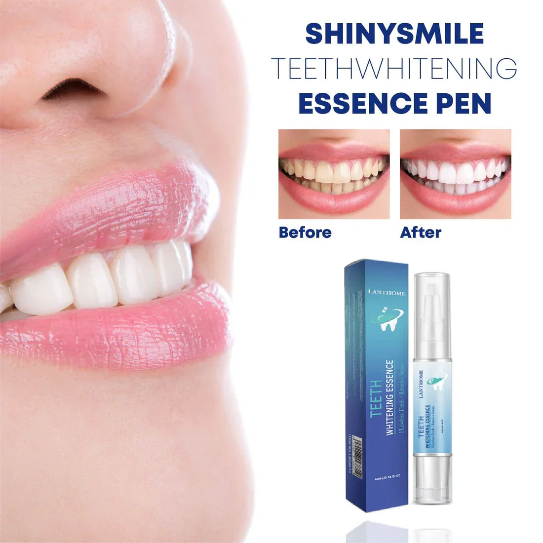 Smilevera Whitening Essence – Milde, effectieve tandverbleking thuis