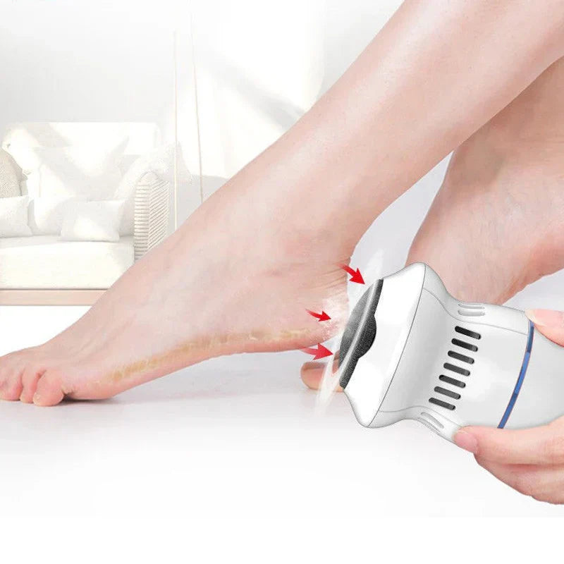 SilkSure – Elektrische eeltverwijderaar met afzuiging – thuis pedicure