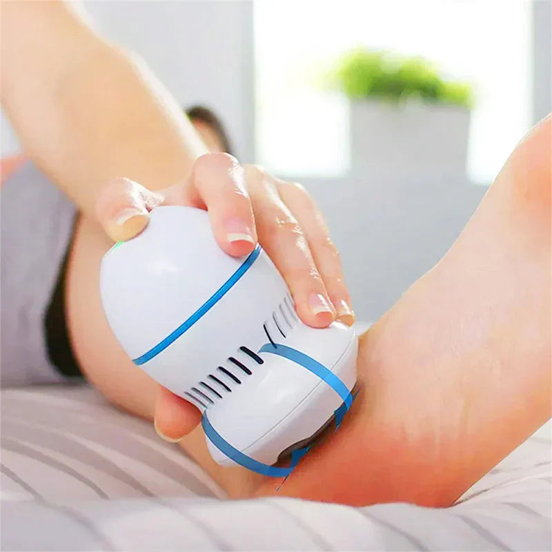 SilkSure – Elektrische eeltverwijderaar met afzuiging – thuis pedicure