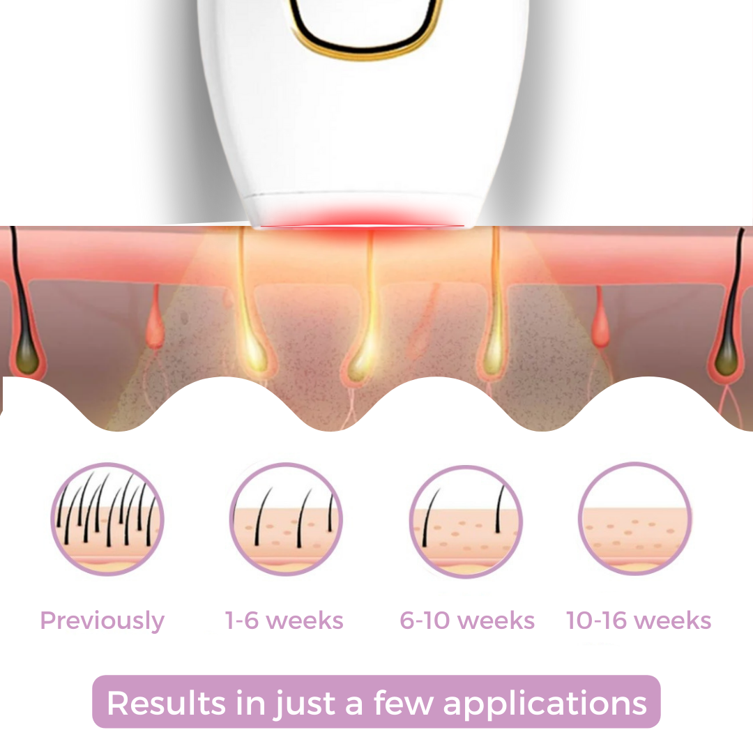 Glowvia IPL-ontharingsapparaat – Pijnloos & permanent voor thuisgebruik
