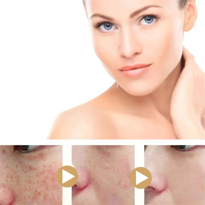 Herbavie – Kurkuma-serum tegen vlekken – voor egale, stralende huid