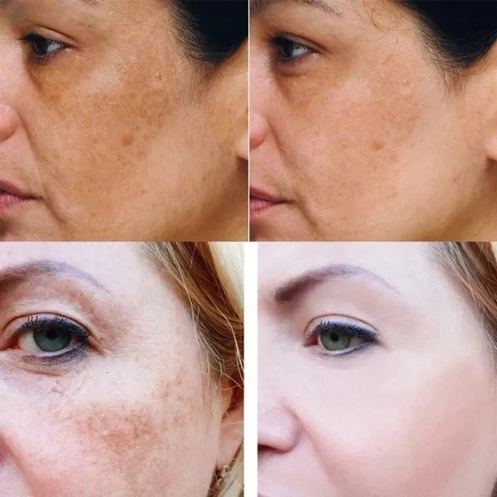 Herbavie – Kurkuma-serum tegen vlekken – voor egale, stralende huid
